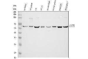 Western blot analysis of CCT2 using anti-CCT2 antibody (ABIN4886512).