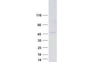 Western Blotting (WB) image for Kinetochore-associated protein DSN1 homolog (DSN1) (Transcript Variant 5) protein (Myc-DYKDDDDK Tag) (ABIN2719772)