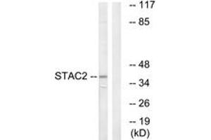 Western blot analysis of extracts from K562 cells, using STAC2 Antibody. (STAC2 抗体  (AA 211-260))