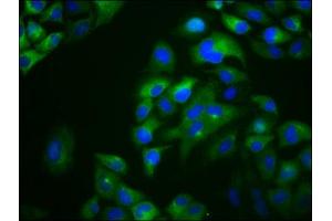 Immunofluorescence staining of Hela cells with ABIN7166575 at 1:133, counter-stained with DAPI. (Otopetrin 1 抗体  (AA 414-544))