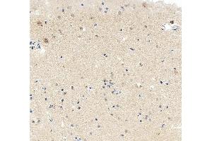 IHC analysis of MEF2C using anti-MEF2C antibody (ABIN6719606).