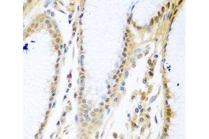 Immunohistochemistry of paraffin-embedded Human stomach using MYBBP1A Polyclonal Antibody at dilution of 1:100 (40x lens). (MYBBP1A 抗体)