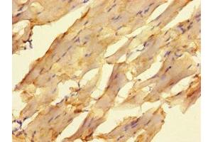 Immunohistochemistry of paraffin-embedded human skeletal muscle tissue using ABIN7176667 at dilution of 1:100 (ELAC1 抗体  (AA 1-363))