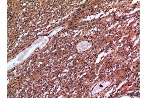 Immunohistochemistry (IHC) analysis of paraffin-embedded Human Brain, antibody was diluted at 1:100. (MME 抗体  (Internal Region))