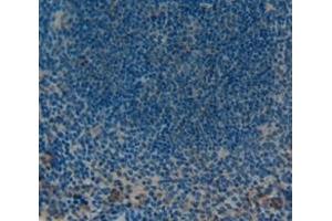 Immunohistochemistry (IHC) image for anti-Protein tyrosine Phosphatase, Receptor Type, H (PTPRH) (AA 685-909) antibody (ABIN2119782)