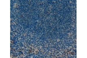 Used in DAB staining on fromalin fixed paraffin- embedded Kidney tissue (PTPRH 抗体  (AA 685-909))