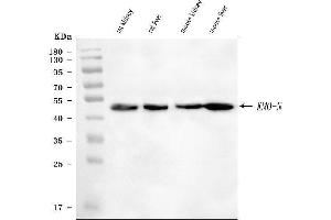 anti-Kynurenine 3-Monooxygenase (Kynurenine 3-Hydroxylase) (KMO) (AA 26-372) antibody