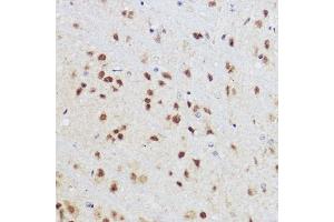 Immunohistochemistry of paraffin-embedded mouse brain using KLF12 antibody (ABIN7268152) at dilution of 1:100 (40x lens). (KLF12 抗体)
