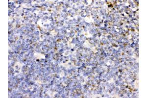 CD27 was detected in paraffin-embedded sections of human tonsil tissues using rabbit anti- CD27 Antigen Affinity purified polyclonal antibody (Catalog # ) at 1 µg/mL. (CD27 抗体  (AA 20-191))