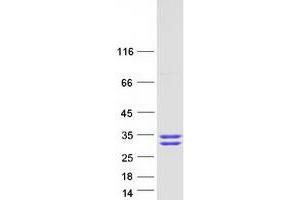 Validation with Western Blot