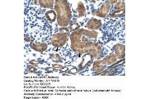 Human kidney (GRIK2 抗体  (N-Term))