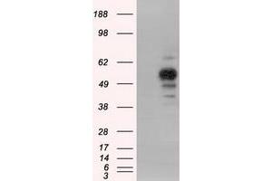 Western Blotting (WB) image for anti-Protein Kinase, CAMP-Dependent, Regulatory, Type II, alpha (PRKAR2A) antibody (ABIN2729600)