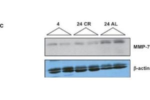 Age-dependent changes in MMP/TIMP expression in the kidney. (MMP7 抗体  (C-Term))