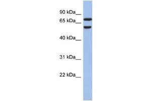 WB Suggested Anti-GNL3L Antibody Titration: 0. (GNL3L 抗体  (N-Term))