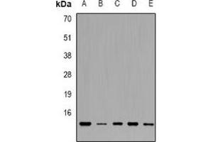 Western blot analysis of TRP14 expression in HL60 (A), Raji (B), K562 (C), SW480 (D), A549 (E) whole cell lysates. (TXNDC17 抗体)