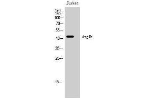 Western Blotting (WB) image for anti-Autophagy related 4B Cysteine Peptidase (ATG4B) (Internal Region) antibody (ABIN3183424) (ATG4B 抗体  (Internal Region))