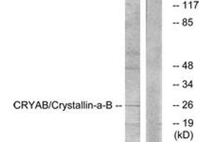 Western blot analysis of extracts from K562 cells, treated with Ca2+ 40nM 30', using CRYAB (Ab-59) Antibody. (CRYAB 抗体  (AA 31-80))