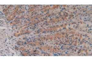 Detection of MMP3 in Rat Stomach Tissue using Polyclonal Antibody to Matrix Metalloproteinase 3 (MMP3) (MMP3 抗体  (AA 278-450))