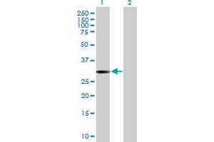 Western Blot analysis of SLC22A24 expression in transfected 293T cell line by SLC22A24 MaxPab polyclonal antibody. (SLC22A24 抗体  (AA 1-322))