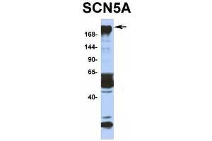 Host:  Rabbit  Target Name:  SCN5A  Sample Type:  Human Fetal Muscle  Antibody Dilution:  1. (SCN5A 抗体  (N-Term))