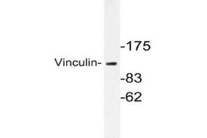 Image no. 1 for anti-Vinculin (VCL) antibody (ABIN272104) (Vinculin 抗体)