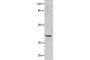 Western blot analysis of Human leiomyosarcoma tissue, using GNA11 Polyclonal Antibody at dilution of 1:450 (GNA11 抗体)