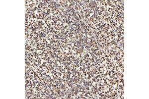 IHC analysis of TST using anti-TST antibody (ABIN7599105). (TST 抗体  (AA 1-220))