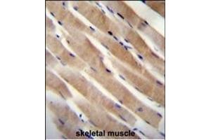 RHEB Antibody (C-term) (ABIN655712 and ABIN2845163) immunohistochemistry analysis in formalin fixed and paraffin embedded human skeletal muscle followed by peroxidase conjugation of the secondary antibody and DAB staining.
