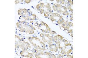 Immunohistochemistry of paraffin-embedded human gastric using SPICE1 antibody at dilution of 1:100 (x40 lens). (SPICE1 抗体)