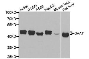 Western blot analysis of extracts of various cell lines, using BAAT antibody. (BAAT 抗体  (AA 309-418))