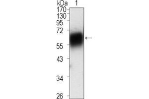 Western blot analysis using ROR1 mouse mAb against extracellular domain of human ROR1 (aa30-423). (ROR1 抗体  (AA 30-406))