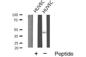 Western blot analysis of Cathepsin E expression in HUVEC cells (Cathepsin E 抗体  (Internal Region))