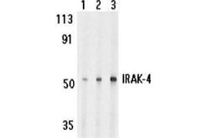 Western blot analysis of IRAK-4 in HeLa cell lysate with AP30442PU-N IRAK-4 antibody at 1 (lane 1), 2 (lane 2), and 4 (lane 3) μg/ml, respectively. (IRAK4 抗体)