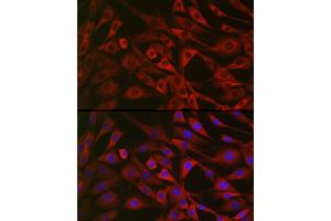 Immunofluorescence analysis of NIH/3T3 cells using IRS2 Rabbit pAb (ABIN6128094, ABIN6142544, ABIN6142545 and ABIN6223949) at dilution of 1:25 (40x lens). (IRS2 抗体  (AA 510-650))