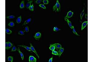 Immunofluorescent analysis of Hela cells using ABIN7176604 at dilution of 1:100 and Alexa Fluor 488-congugated AffiniPure Goat Anti-Rabbit IgG(H+L) (SLUG 抗体  (AA 12-124))