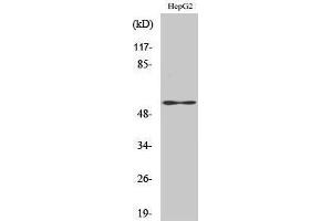 Western Blotting (WB) image for anti-Vimentin (VIM) (C-Term) antibody (ABIN3177923) (Vimentin 抗体  (C-Term))