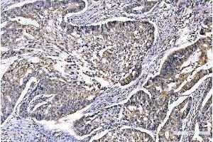 IHC analysis of GFPT1 using anti-GFPT1 antibody (ABIN7602887). (GFPT1 抗体  (C-Term))