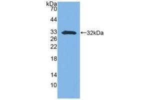 Detection of Recombinant SFN, Mouse using Polyclonal Antibody to Stratifin (SFN) (14-3-3 sigma/SFN 抗体  (AA 1-249))