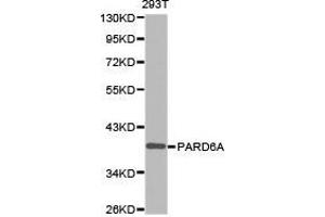 Western Blotting (WB) image for anti-Par-6 Partitioning Defective 6 Homolog alpha (PARD6A) antibody (ABIN1874031) (PARD6A 抗体)