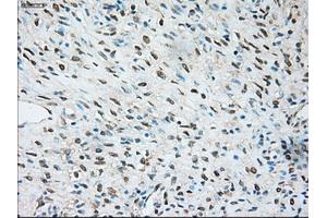 Immunohistochemistry (IHC) image for anti-Transient Receptor Potential Cation Channel, Subfamily M, Member 4 (TRPM4) antibody (ABIN2725815)