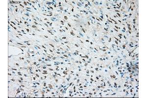 Immunohistochemical staining of paraffin-embedded Kidney tissue using anti-TRPM4mouse monoclonal antibody. (TRPM4 抗体)