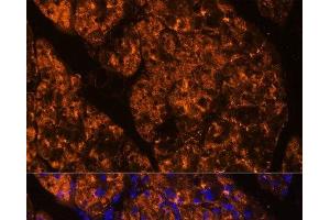 Immunofluorescence analysis of Rat pancreas using SERPINI2 Polyclonal Antibody at dilution of 1:100 (40x lens). (SERPINI2 抗体)
