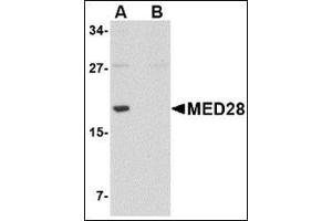 Western blot analysis of MED28 in human brain tissue lysate with this product at 1 μg/ml in (A) the absence and (B) the presence of blocking peptide. (MED28 抗体  (Center))