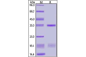 SARS-CoV-2 NSP16&NSP10 Heterodimer Protein, His Tag&Twin Strep Tag on SDS-PAGE under reducing (R) condition. (SARS-CoV-2 NSP16, NSP10 protein (His tag,Twin-Strep tag))