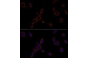 Immunofluorescence analysis of C6 cells using Caspase-9 antibody (ABIN6131534, ABIN6137975, ABIN6137977 and ABIN6213766) at dilution of 1:100.