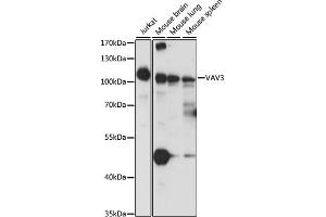 Western blot analysis of extracts of various cell lines, using V antibody  at 1:1000 dilution. (VAV3 抗体  (AA 560-680))