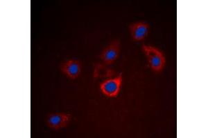Immunofluorescent analysis of BCL2 staining in HeLa cells. (Bcl-2 抗体  (Center))