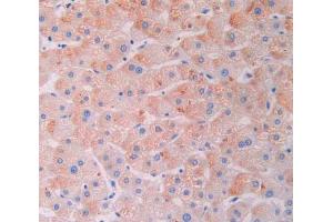 IHC-P analysis of liver tissue, with DAB staining. (LGALS9B 抗体  (AA 17-148))