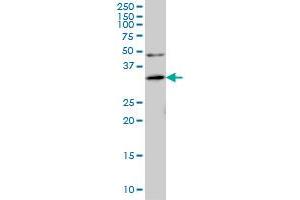 Western Blotting (WB) image for anti-Ankyrin Repeat, Family A (RFXANK-Like), 2 (ANKRA2) (AA 1-98) antibody (ABIN566167)