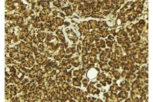 ABIN6279411 at 1/100 staining Mouse pancreas tissue by IHC-P. (NEIL2 抗体  (Internal Region))